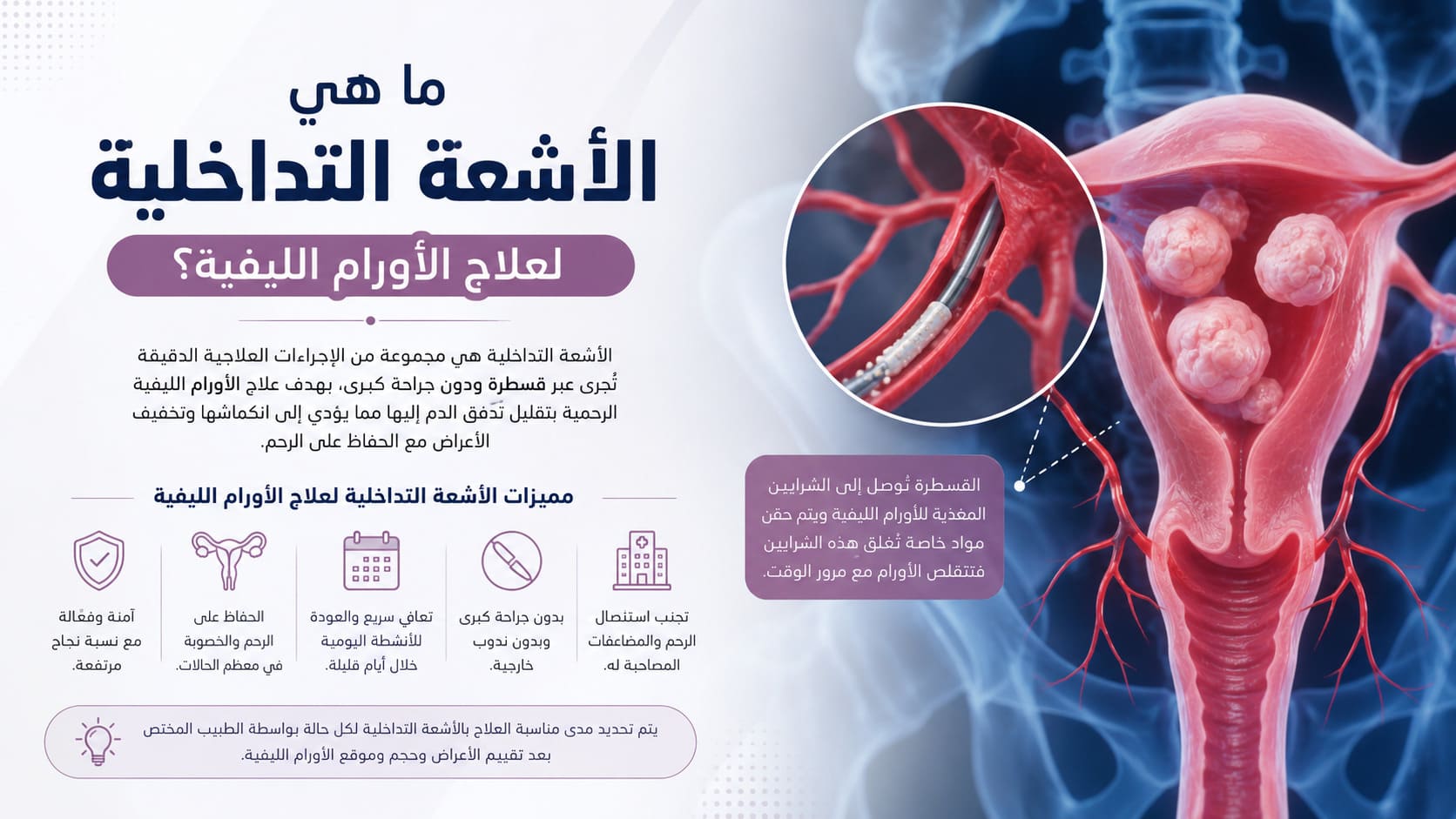 ما هي الأشعة التداخلية لعلاج الأورام الليفية؟