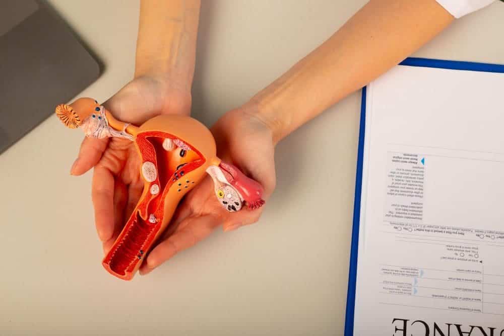 Uterine Artery Embolization for Fibroids: A Safe, Non-Surgical Solution