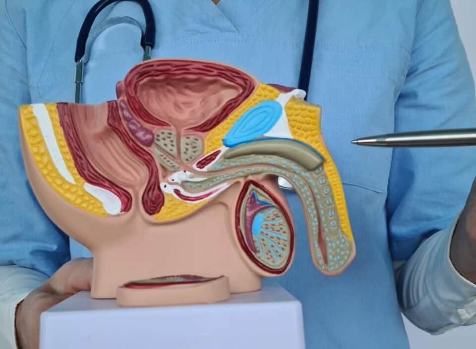 prostate embolization technique