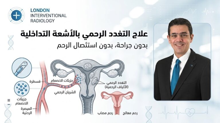 علاج التغدد الرحمي