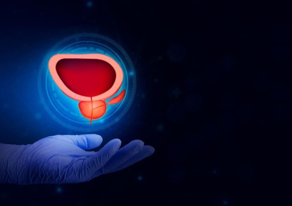 how long does prostate artery embolization last