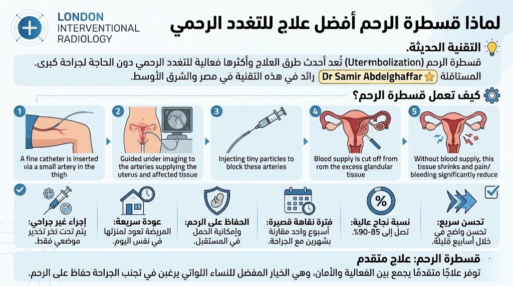 لماذا قسطرة الرحم أفضل علاج للتغدد الرحمي