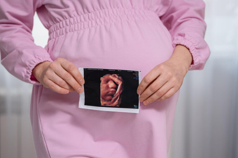 Can You Get Pregnant After Uterine Artery Embolization?