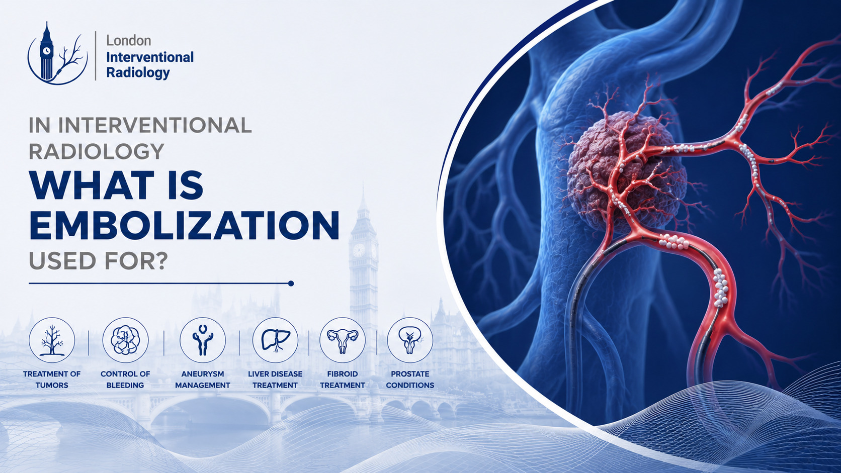 In Interventional Radiology What Is Embolization Used For?