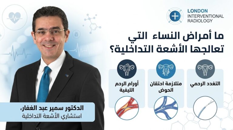 ما أمراض النساء التي تعالجها الأشعة التداخلية؟