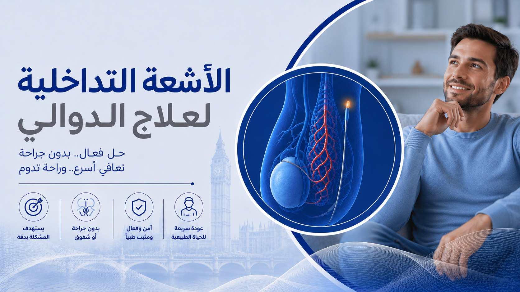 الاشعة التداخلية للدوالي