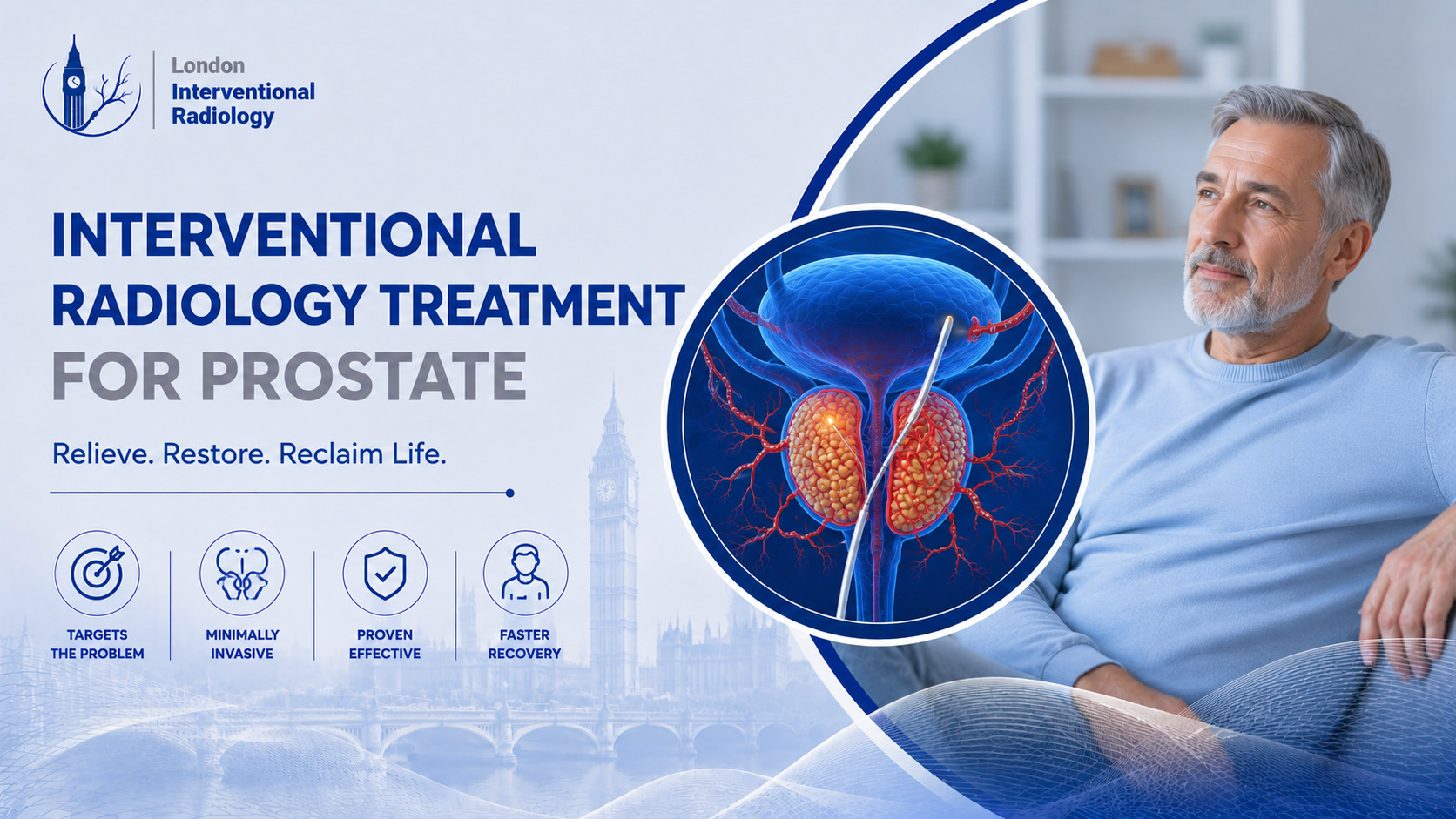 علاج تضخم البروستاتا بالاشعة التداخلية