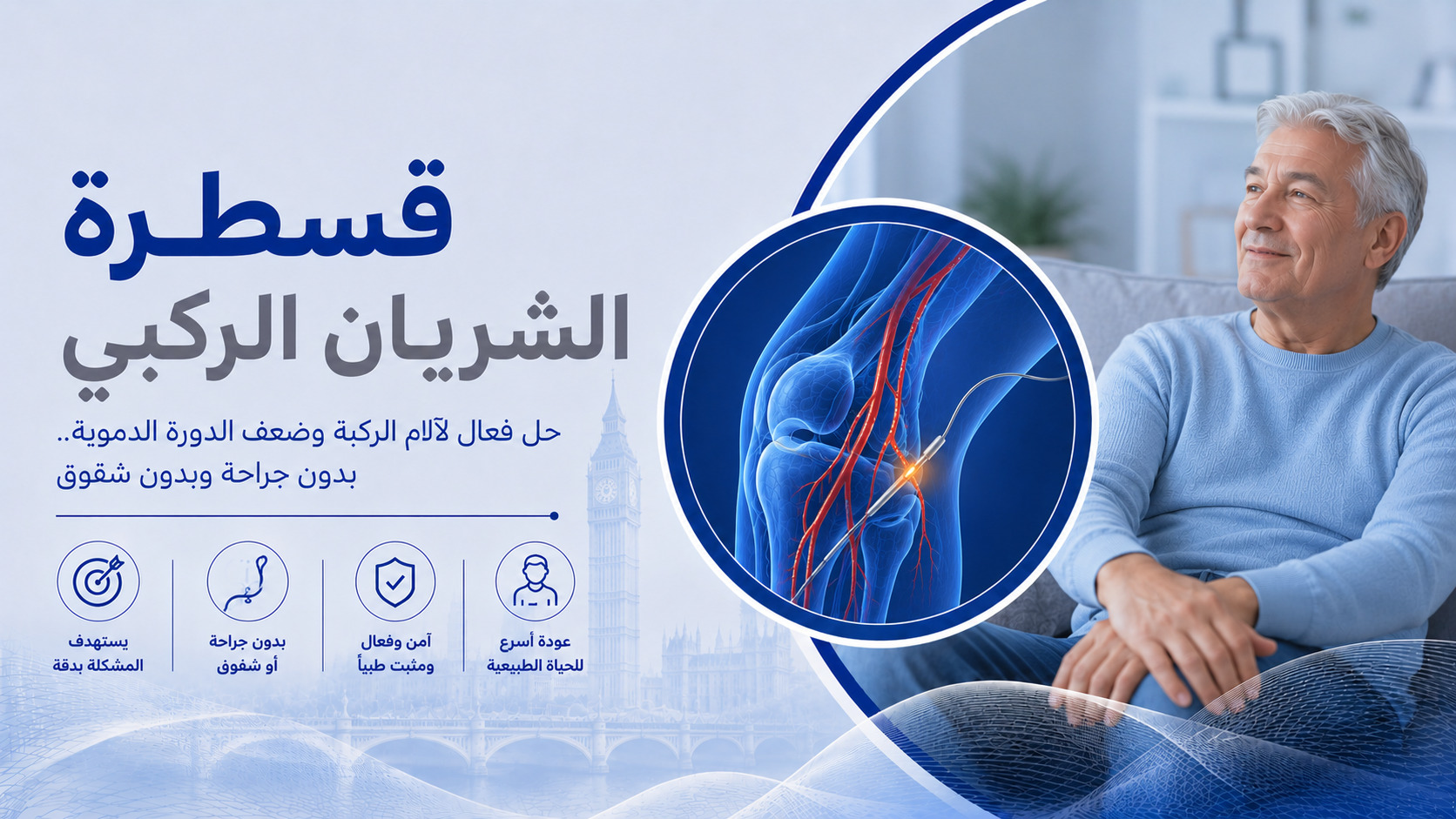 قسطرة الشريان الركبي